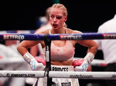 RICHARD PELHAM Ebanie Bridges of Australia with bad eye injury after her world WBA Bantamweight defeat over 10 rounds against rival Shannon Courtenay