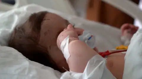 BBC A six-month-old girl in Adana hospital