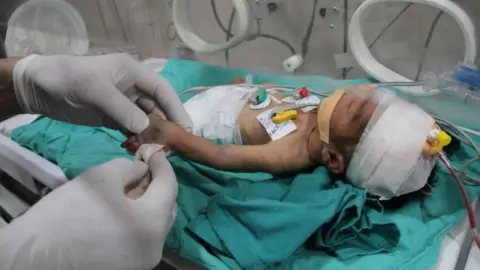 Getty Images baby hospitalised because of malnutrition in incubator at Kamal Adwan