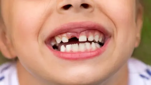 Getty Images A child with their tooth missing