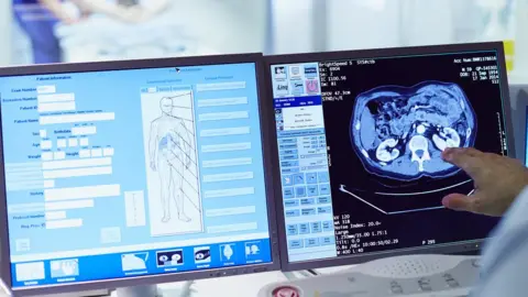 Getty Images CT Scan