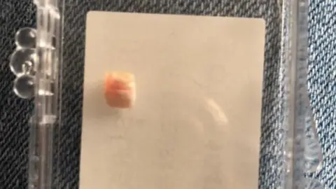 JASMIN HEASMAN tooth