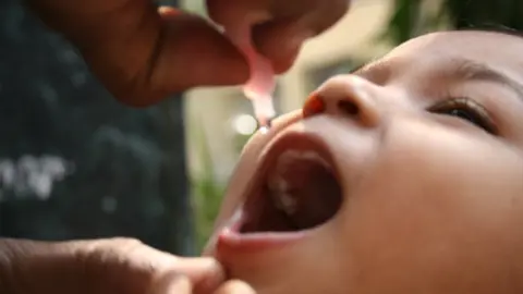 Getty Images child being given oral polio vaccine