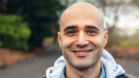 Getty Images A bald man