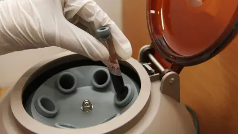 ROLEX DELA PENA A centrifuge machine