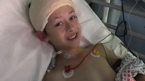 Brain Tumour Research Ben Parton after brain surgery