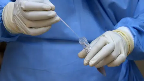 Reuters Doc tests virus in tube