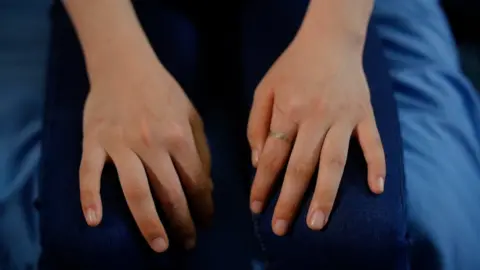 Jiyun's hands marked by scratches after a five hour mountain ascent over the Chinese border