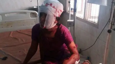 The injured woman in hospital