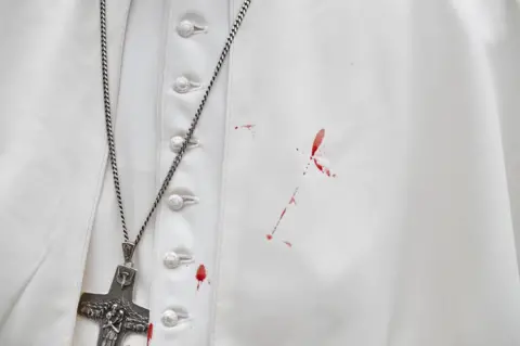 Alberto PIZZOL/ Reuters The pope's white tunic is stained with blood.