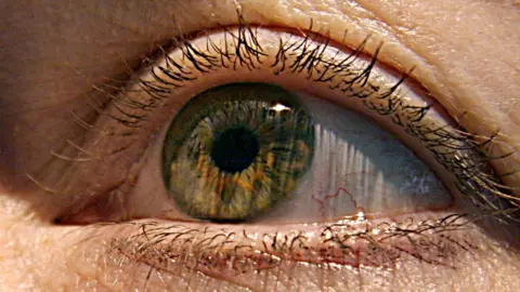AFP A human eye