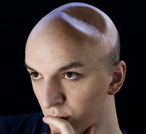 Eddie Adams Eddie Adams with his misshapen skull