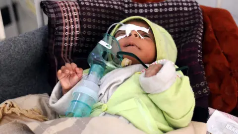 Getty Images A malnourished child gets medical attention in Yemen in this 2017 file photo