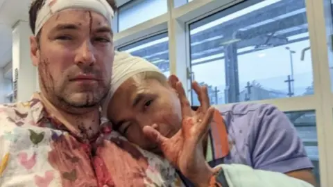 BBC Rob and Patrick after the attack