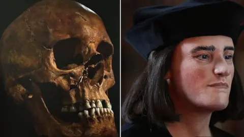 Getty Images Richard III skull next to facial reconstruction