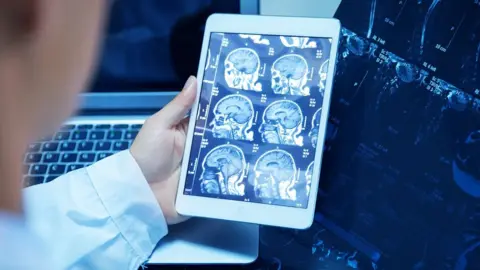 Getty Images A doctor checking a scan in a tablet