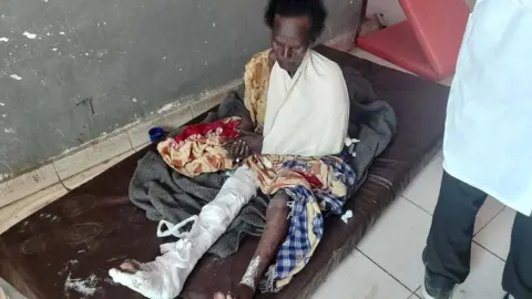 Reuters Woman injured by air strike in Ethiopia's Tigray region