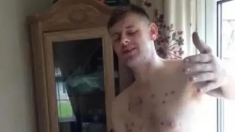 Cullan Mais Cullan Mais (when he was addicted to drugs)