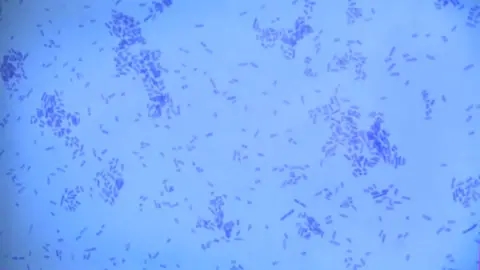 Microscope image of swabbed bacteria