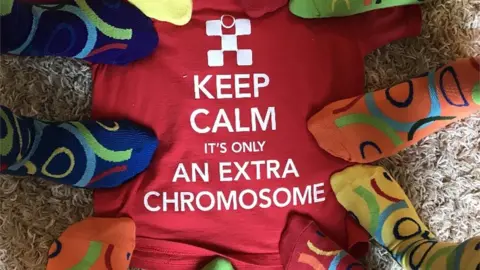 Family photo Socks on a Tshirt which says Keep calm it's only an extra chromosome