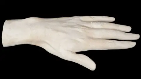 Reeman Dansie Diana's hand