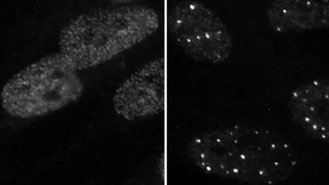 University of the West of Scotland Uninfected cells (left) and infected cells (right). The bright dots are Hira proteins concentrating to fight the viral infection