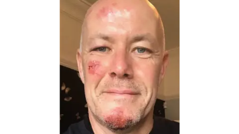 Phil Williams Cyclist Phil Williams with facial injuries after the hit and run