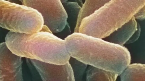 Science Photo Library Coloured scanning electron micrograph (SEM) of Escherichia coli 0157:H7