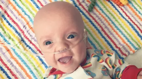 Birmingham Children's Hospital Arlo Watson