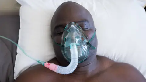 Getty Images A man on a respirator in South Africa