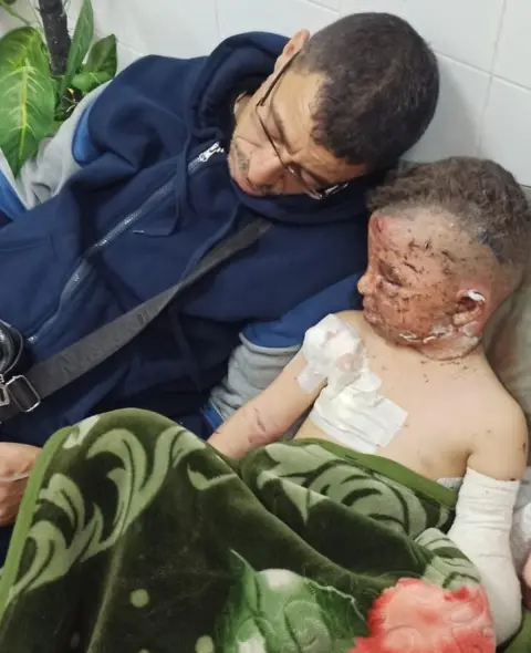 MOEIN ABU REZK Omar (right) with his uncle Moein Abu Rezk at Al-Aqsa Martyrs Hospital in Deir al-Balah, in the central Gaza Strip