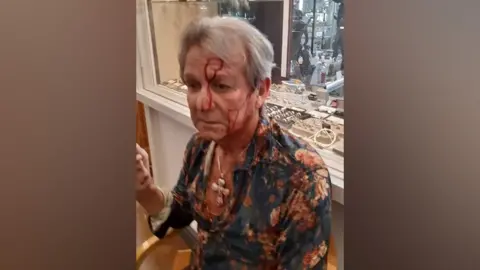 Ian Towning Mr Towning with blood on his face after the attack