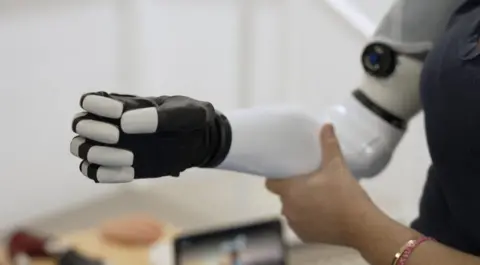 Bionic arm