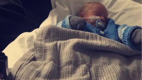 Sherwood Forest Hospitals Baby Cobie