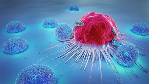 Getty Images Cancer cells