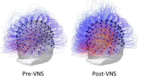 Corazzol et al Brain scan