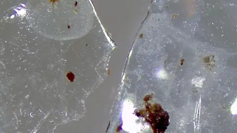 Charles Rolsky contact lens