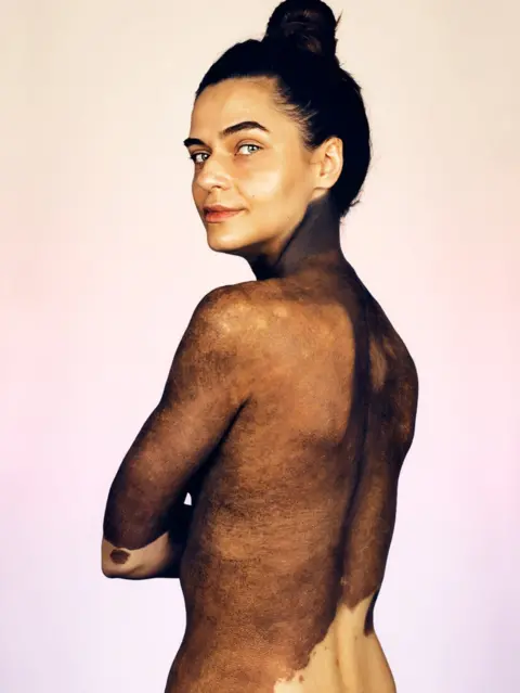 Brock Elbank Agnieszka Palyska