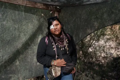 NATALIA FAVRE Portrait of Elva Valerio, who was wounded in the eye by a rubber bullet fired at her by police during the June 17 crackdown at the roadblock in Purmamarca, Jujuy province, Argentina, June 27, 2023.