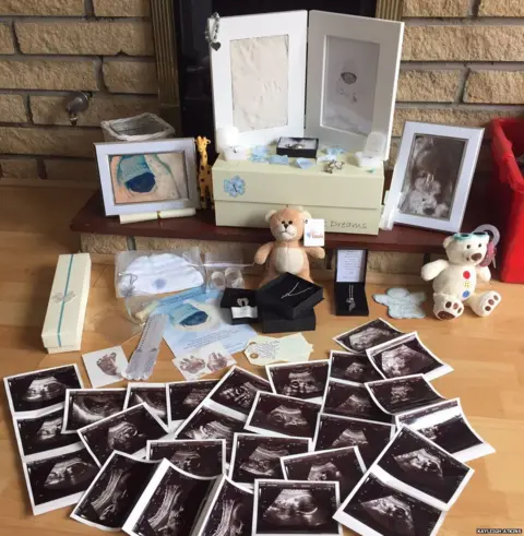 Kayleigh Atkins A memory box of scans and baby toys and teddies