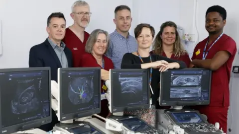 Royal Devon University Healthcare Close up of ultrasound machines