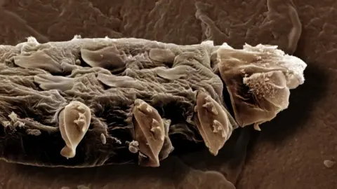 The tiny mites that have sex on our faces have a problem 