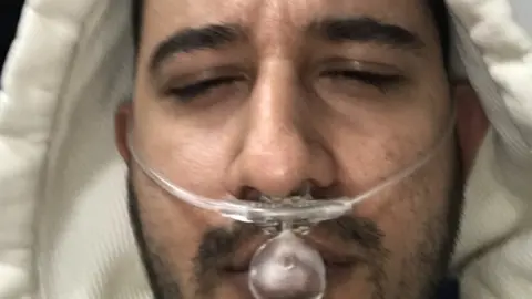 Rishi Modi Rishi Modi following the fire in September 2017 being treated for smoke inhalation