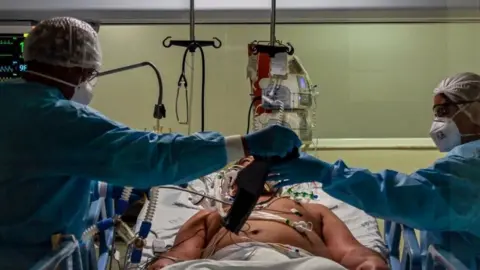 AFP/Getty Images Medics attend to a Covid-19 infected patient in an intensive care unit in São Paulo, Brazil. Photo: April 2020