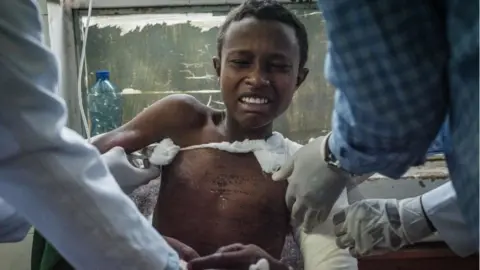 Getty Images A Togoga injured residents, a village about 20km west of Mekele, where an alleged airstrike hit a market leaving an unknown number of casualties, receives medical treatments at the Ayder referral hospital in Mekele, the capital of Tigray region, Ethiopia, on June 23, 2021.