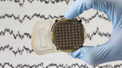 Fonds de dotation Clinatec  Sensors read brain activity