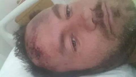 Andy Scott Andy Scott recovering after his accident