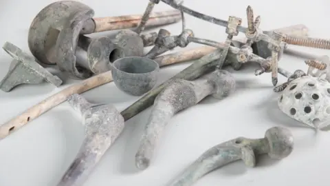 Orthometals Metals remaining after cremation are removed with tongs and a magnet