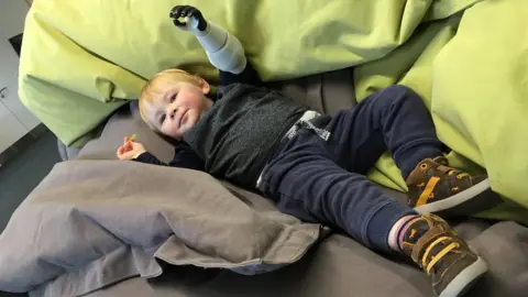 BBC Sol with his bionic arm