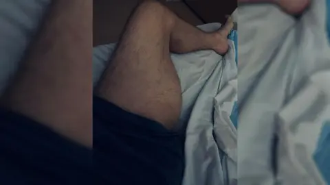 Gordon Hunt Gordon Hunt leg tumour